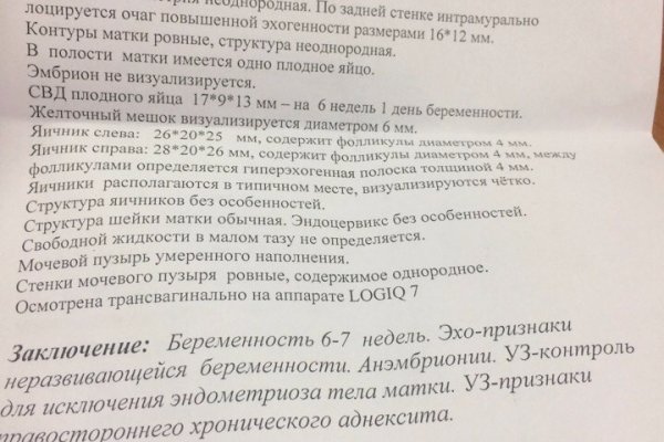 Пользователь не найден при входе на кракен